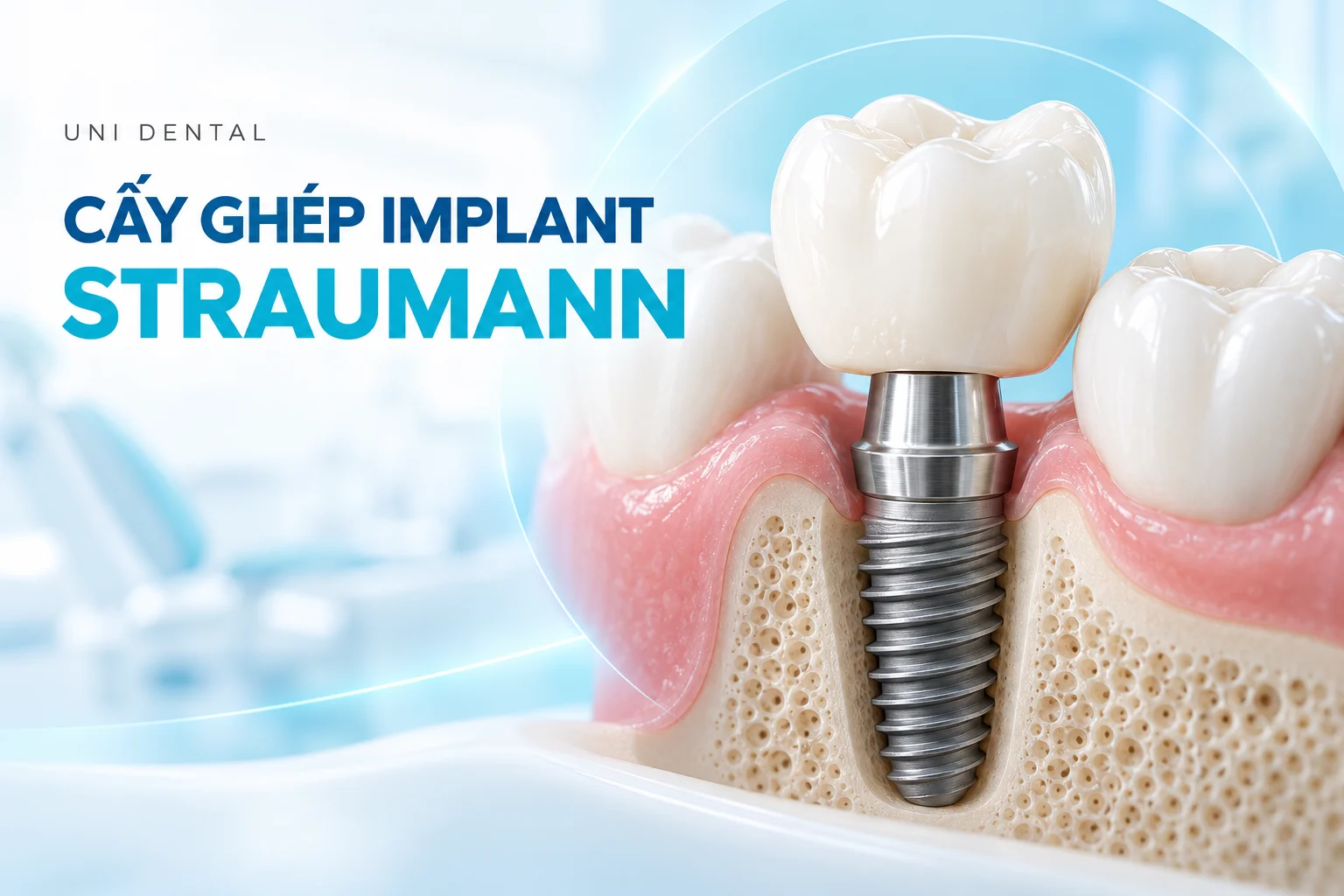Trụ Implant Straumant ( Thuỵ Sĩ )
