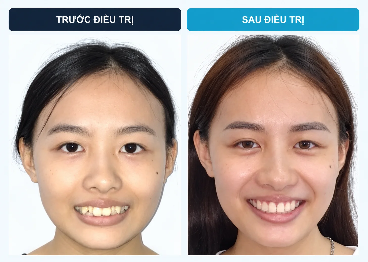 Trúc Đoàn