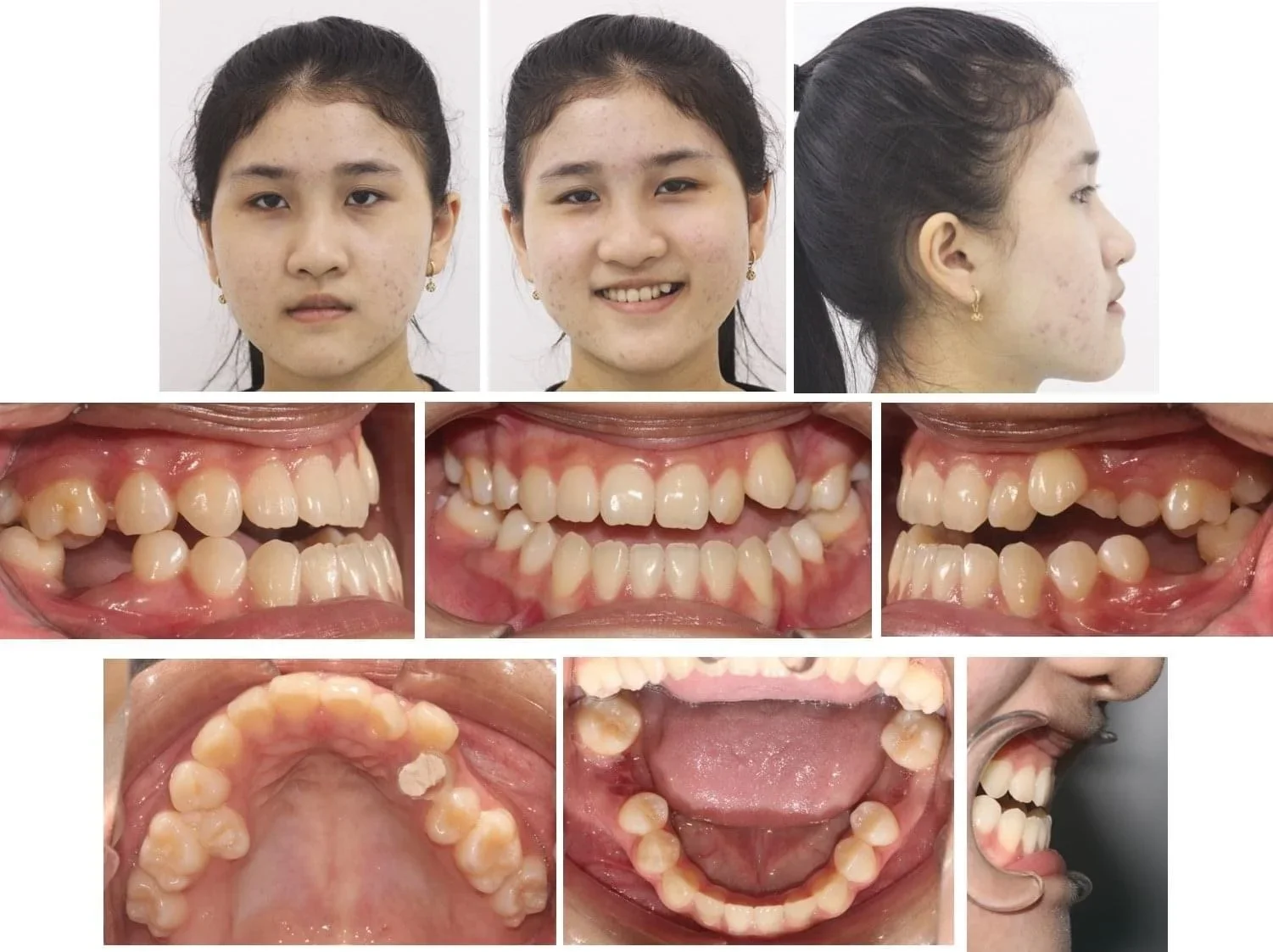 Nguyễn Khánh Linh