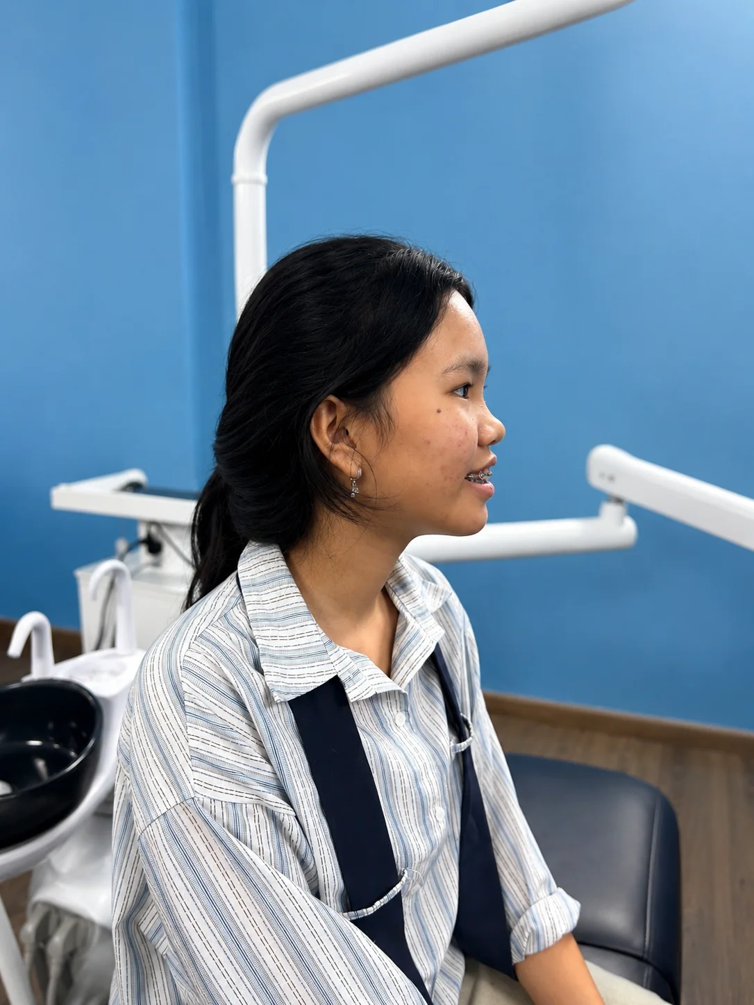 Case niềng răng giảm hô tại Uni Dental