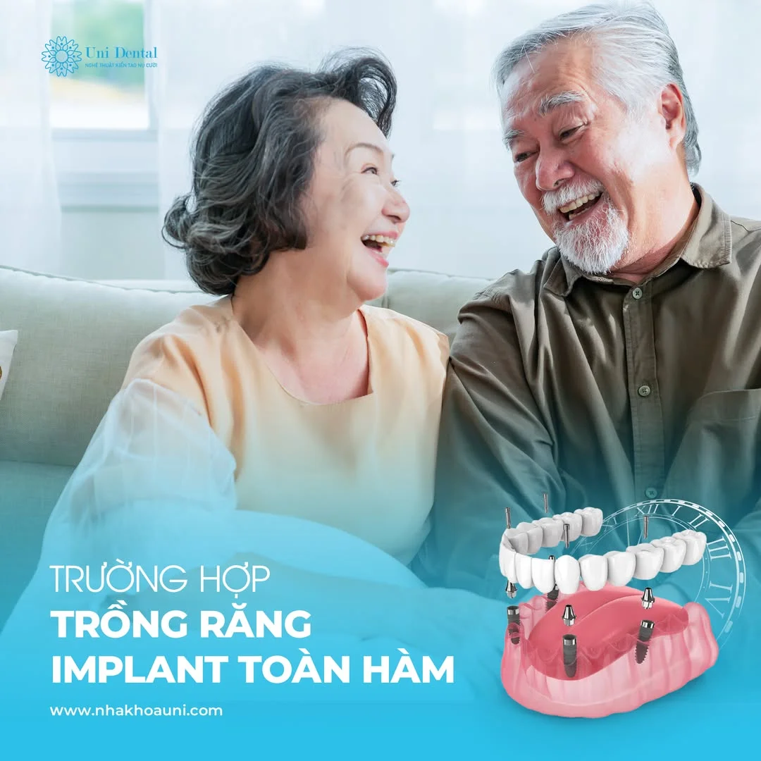 Trồng Răng Implant Toàn Hàm All-on-4 or 6